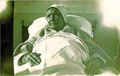 Zuster Lambertine op haar sterfbed. Tot kort vóór haar dood trok ze zich het lot aan van leprapatiënten. © Dirk D’Haese